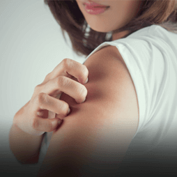 Asthma & allergic reactions